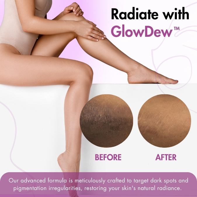 GlowDew™ Glimmer Intimate Whitening Cream