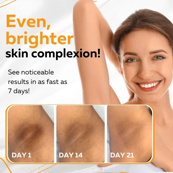 Luminovate™ Dark Skin Areas Cream