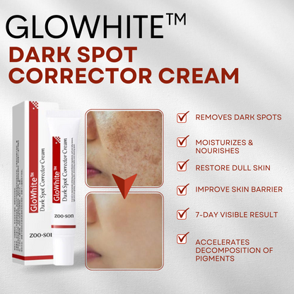 GloWhite™ Dark Spot Corrector Cream