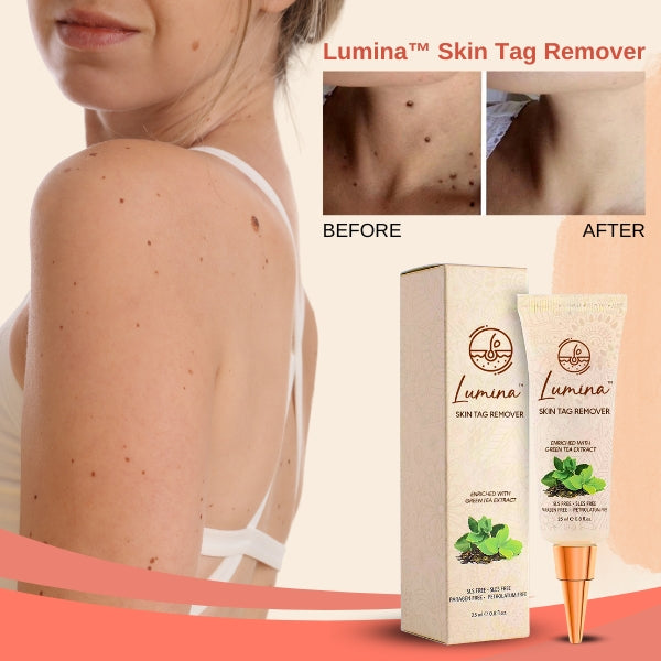 Lumina™ Skin Tag Remover