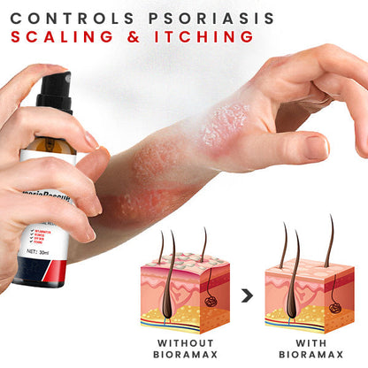 BIORAMAX Essence PsoriaRescue Treatment Spray